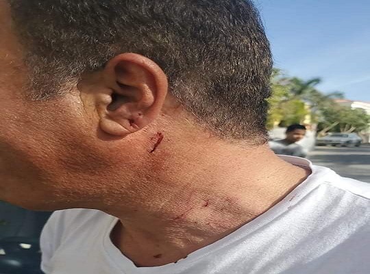 كشف أيمن يونس تفاصيل جديدة عن اعتداءه على واجهة المنزل. كشف أيمن يونس تفاصيل جديدة عن اعتداءه أمام منزله.