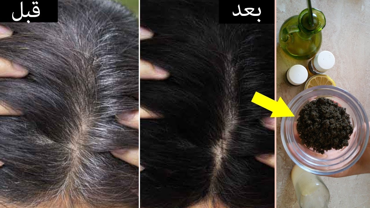 خالي من المواد الكيماوية أو الصبغات .. معجزة القرنفل في إزالة الشيب المبكر لن تتكرر كالنتائج الرائعة من أول استخدام 4