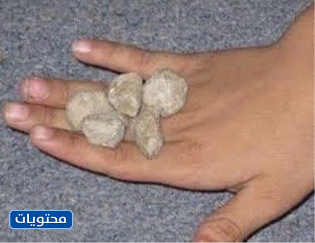 لعبة المراقبة