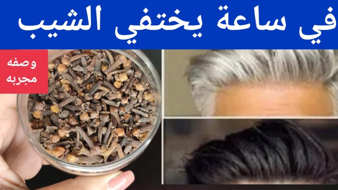 خالي من المواد الكيماوية أو الصبغات .. معجزة القرنفل في إزالة الشيب المبكر لن تتكرر كالنتائج الرائعة من أول استخدام 4